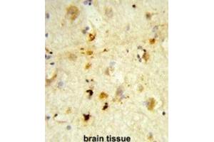 Immunohistochemistry (IHC) image for anti-Integrin, beta-Like 1 (With EGF-Like Repeat Domains) (ITGBL1) antibody (ABIN3003908)
