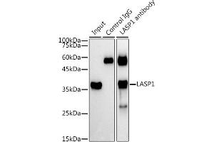 Immunoprecipitation analysis of 300 μg extracts of A-549 cells using 3 μg L antibody (ABIN1680664, ABIN3018314, ABIN3018315 and ABIN6220434).