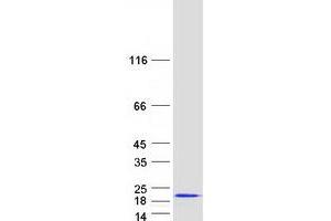 Validation with Western Blot