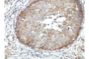 Immunohistochemical staining of formalin-fixed paraffin-embedded fetal urinary bladder showing nuclear staining with BRD9 Antibody at a dilution of 1/100. (BRD9 anticorps  (AA 264-475))