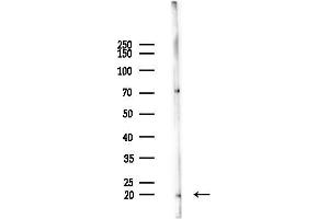 anti-Tumor Necrosis Factor, alpha-Induced Protein 8-Like 2 (TNFAIP8L2) (Internal Region) antibody