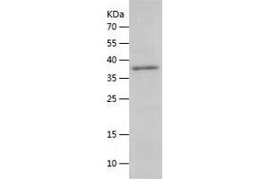 Western Blotting (WB) image for AKT1 Substrate 1 (Proline-Rich) (AKT1S1) (AA 1-256) protein (His tag) (ABIN7121759)