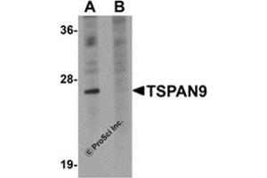 Western blot analysis of TSPAN9 in EL4 cell lysate with this product at 1 μg/ml in (A) the absence and (B) the presence of blocking peptide. (Tetraspanin 9 anticorps  (Center))