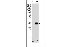Western blot analysis of G5 (arrow) using rabbit polyclonal G5 Antibody 1812c. (ATG5 anticorps)