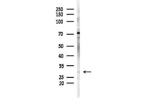 anti-Loricrin (LOR) (N-Term) antibody
