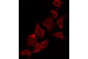 ABIN6267557 staining HeLa by IF/ICC.