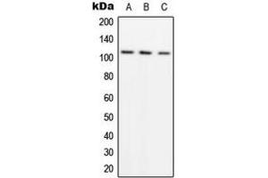 Western blot analysis of ADAMTS1 expression in A549 (A), SW480 (B), HeLa (C) whole cell lysates. (ADAMTS1 anticorps  (Center))