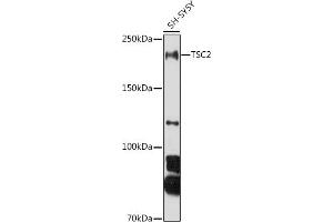 Western blot analysis of extracts of SH-SY5Y cells, using TSC2 antibody (ABIN6128542, ABIN6149611, ABIN6149612 and ABIN6213862) at 1:1000 dilution. (Tuberin anticorps  (AA 900-1150))