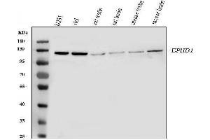 Western blot analysis of Eph receptor B1 using anti-Eph receptor B1 antibody (ABIN3042375). (EPH Receptor B1 anticorps  (N-Term))