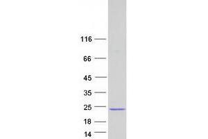 Validation with Western Blot
