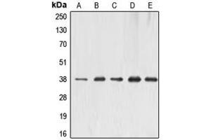 Western blot analysis of ERCC1 expression in MCF7 (A), HeLa (B), A431 (C), mouse liver (D), rat kidney (E) whole cell lysates. (ERCC1 anticorps  (Center))