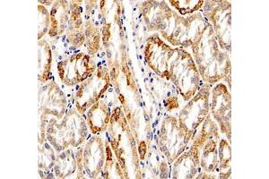 Immunohistochemistry of paraffin embedded mouse kidney using Aldh4a1 (ABIN7073000) at dilution of 1: 1200 (400x lens)