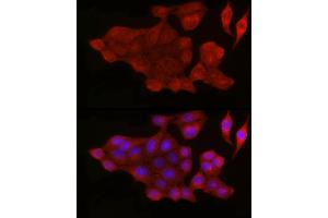 Immunofluorescence analysis of HeLa cells using [KO Validated] Bax Rabbit pAb (ABIN3020682, ABIN3020683, ABIN3020684, ABIN1512622 and ABIN6213665) at dilution of 1:50 (40x lens). (BAX anticorps  (AA 1-100))