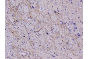 IHC analysis of NSE using anti-NSE antibody (ABIN6719549). (ENO2/NSE anticorps)