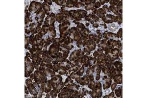 Immunohistochemical staining of human pancreas with PRSS16 polyclonal antibody  shows strong cytoplasmic positivity in exocrine glandular cells at 1:50-1:200 dilution.