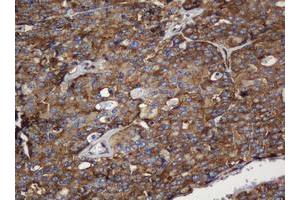 Image no. 13 for anti-SERPINE1 mRNA Binding Protein 1 (SERBP1) (AA 1-262) antibody (ABIN1490675)