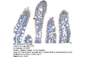 Rabbit Anti-OTC Antibody  Paraffin Embedded Tissue: Human Intestine Cellular Data: Epithelial cells of intestinal villas Antibody Concentration: 4. (OTC anticorps  (N-Term))