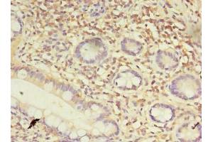 Immunohistochemistry of paraffin-embedded human small intestine tissue using ABIN7164351 at dilution of 1:100 (DDX31 anticorps  (AA 560-851))
