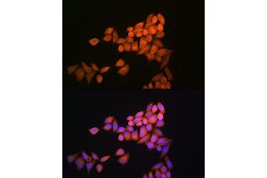 Immunofluorescence analysis of NIH-3T3 cells using Thioredoxin 1 (Trx1/Thioredoxin 1 (Trx1/TXN)) Rabbit pAb (ABIN6133954, ABIN6149719, ABIN6149721 and ABIN6213598) at dilution of 1:100 (40x lens). (TXN anticorps  (AA 1-100))