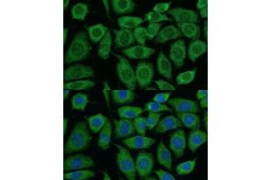 Immunofluorescence analysis of L929 cells using DLAT antibody (ABIN7266768) at dilution of 1:100.