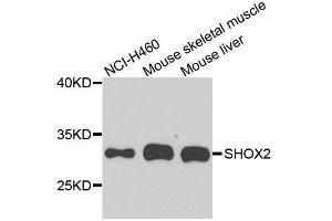 Western blot analysis of extracts of various cell lines, using SHOX2 antibody. (SHOX2 anticorps  (AA 96-355))