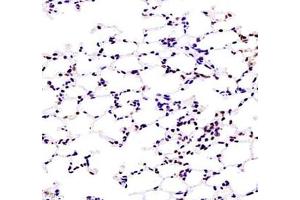 Immunohistochemistry of paraffin embedded mouse lung using ZKSCAN4 (ABIN7076265) at dilution of 1:1300 (400x lens) (ZKSCAN4 anticorps)
