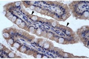 Human Intestine; SMPDL3B antibody - N-terminal region in Human Intestine cells using Immunohistochemistry (SMPDL3B anticorps  (N-Term))