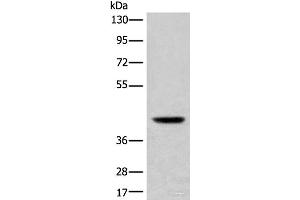 Western blot analysis of Mouse liver tissue lysate using USP12 Polyclonal Antibody at dilution of 1:700 (USP12 anticorps)