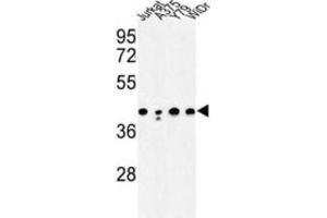 Western Blotting (WB) image for anti-Calcium Activated Nucleotidase 1 (CANT1) antibody (ABIN3003928)