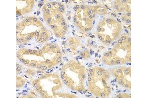 Immunohistochemistry of paraffin-embedded Human kidney using ELMO3 Polyclonal Antibody at dilution of 1:100 (40x lens).