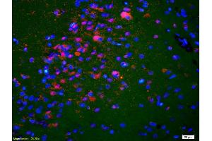Formalin-fixed and paraffin-embedded rat brain labeled with Anti-KIF5A/NKHC1 Polyclonal Antibody, Unconjugated (ABIN1387674) 1:200, overnight at 4°C, The secondary antibody was Goat Anti-Rabbit IgG, Cy3 conjugated used at 1:200 dilution for 40 minutes at 37°C. (K5A/ NKHC1 (AA 201-300) anticorps)