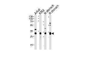 Western blot analysis of lysates from Jurkat, K562 cell line, mouse stomach and rat stomach tissue (from left to right), using ESD Antibody (Center) (ABIN1882167 and ABIN2838493). (Esterase D anticorps  (AA 68-102))