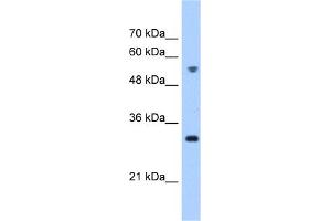 WB Suggested Anti-TTC5 Antibody Titration:  0. (TTC5 anticorps  (C-Term))