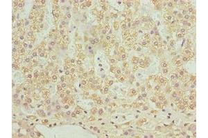 Immunohistochemistry of paraffin-embedded human adrenal gland tissue using ABIN7170079 at dilution of 1:100 (SLC12A4 anticorps  (AA 601-900))