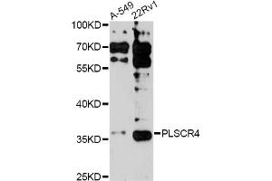 Western blot analysis of extracts of various cell lines, using PLSCR4 antibody (ABIN6291579) at 1:3000 dilution. (PLSCR4 anticorps)