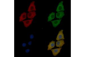 YTHDF3 Mouse Monoclonal Antibody staining Hela cells by IF/ICC. (YTHDF3 anticorps)