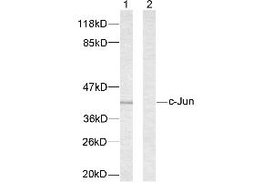 Western blot analysis of extracts from NIH/3T3 cells treated with UV. (C-JUN anticorps  (Ser63))