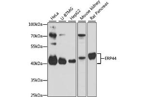 Western blot analysis of extracts of various cell lines, using ERP44 antibody (ABIN1679753, ABIN3019013, ABIN3019014 and ABIN6220673) at 1:3000 dilution. (ERP44 anticorps  (AA 57-406))