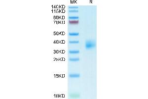 Mouse TSLPR on Tris-Bis PAGE under reduced condition. (TLSPR (AA 20-232) (Active) protein (His tag))