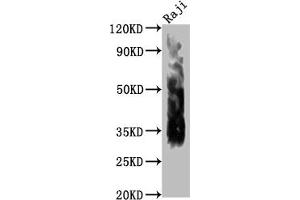 Western Blot Positive WB detected in: Raji whole cell lysate All lanes CD63 antibody at 1:1000 Secondary Goat polyclonal to mouse IgG at 1/50000 dilution Predicted band size: 30-120 KD KDa Observed band size: 30-120 KD KDa Exposure time:1 min