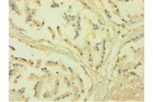 Immunohistochemistry of paraffin-embedded human prostate tissue using ABIN7161023 at dilution of 1:100 (POR anticorps  (AA 2-671))
