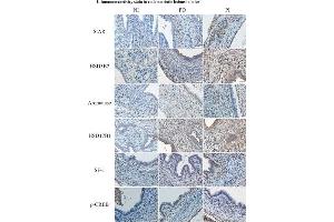Effect of non-immune serum (NI), platelet infusion (PI) and platelet depletion (PD) on lesional development and lesional expression of steroidogenic proteins in mice with induced endometriosis.