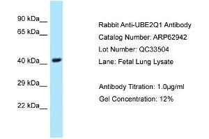 Western Blotting (WB) image for anti-Ubiquitin-Conjugating Enzyme E2Q Family Member 1 (UBE2Q1) (Middle Region) antibody (ABIN2789308) (UBE2Q1 anticorps  (Middle Region))