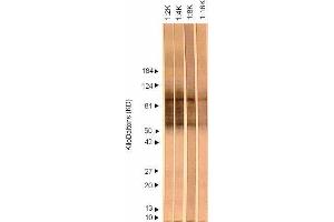 Western Blotting (WB) image for anti-Herpes Simplex Virus Type 2, Glycoprotein G (HSV2 gG) antibody (ABIN265564)
