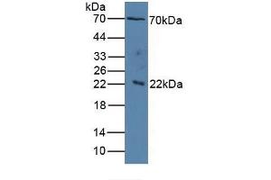 Detection antibody from the kit in WB with Positive Control:  Sample Human serum. (IL1RAP Kit ELISA)