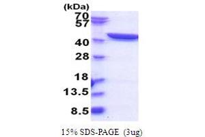 SDS-PAGE (SDS) image for Glutamine--Fructose-6-Phosphate Transaminase 1 (GFPT1) (AA 332-699) protein (His tag) (ABIN5853831)