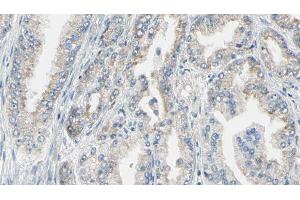 ABIN6276720 at 1/100 staining Human prostate tissue by IHC-P.
