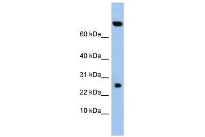 WB Suggested Anti-ZSWIM3 Antibody Titration: 0. (ZSWIM3 anticorps  (N-Term))