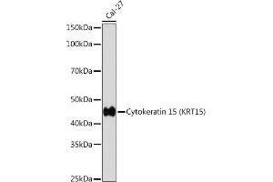 Western blot analysis of extracts of Cal-27 cells, using Cytokeratin 15 (KRT15) (KRT15) antibody (ABIN7268093) at 1:1000 dilution.