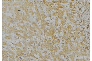 ABIN6272963 at 1/100 staining Mouse liver tissue by IHC-P.